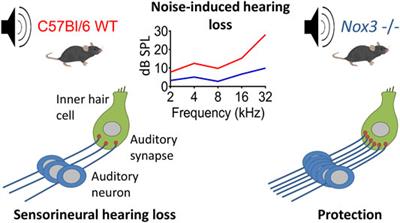 NADPH Oxidase 3 Deficiency Protects From Noise-Induced Sensorineural Hearing Loss